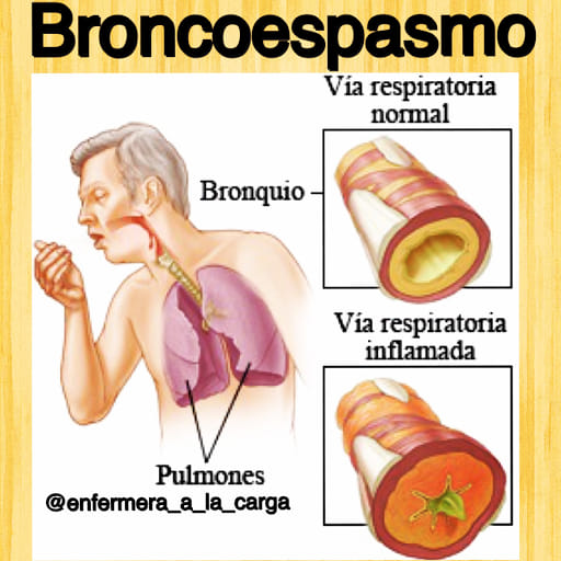 qu-es-un-broncoespasmo-y-qu-lo-causa-un-broncoespasmo-ocurre-cuando