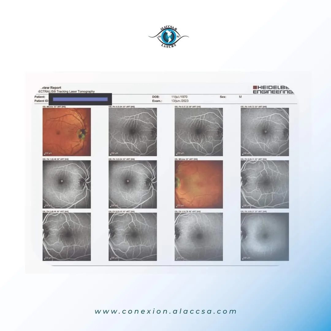 Alaccsa-R - Descifrando Dilemas Oftalmológicos 👁 Les presentamos el ...