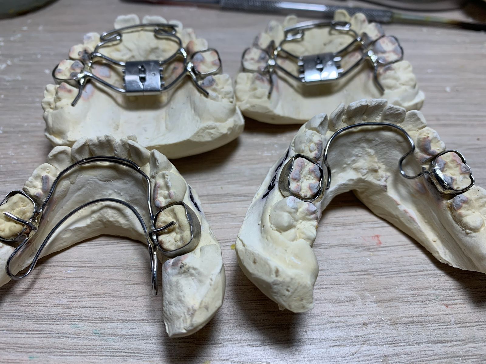 retainers_labdental