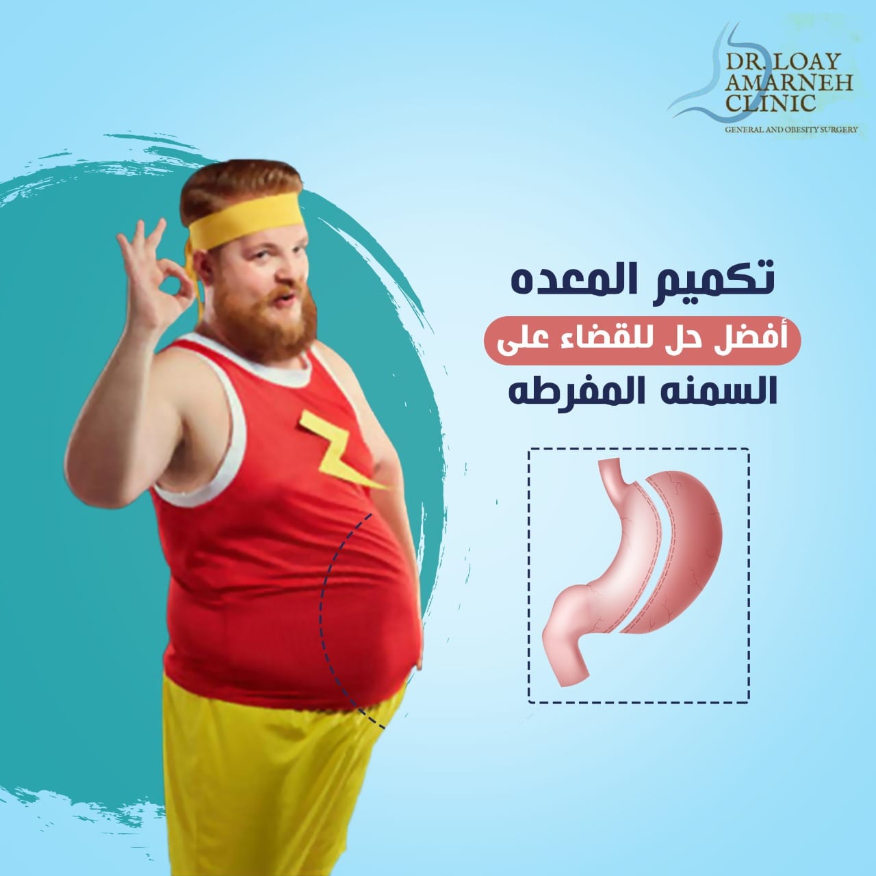 عيادة الدكتور لؤي عمارنة Dr Amarneh Clinic عملية التكميم هي عبارة عن قص المعدة بشكل الك م وبنسبة ٧٥ الى ٩٠ بالمئة وتعتمد هذه النسبة على حجم المعدة اصلا عند المريض ومن