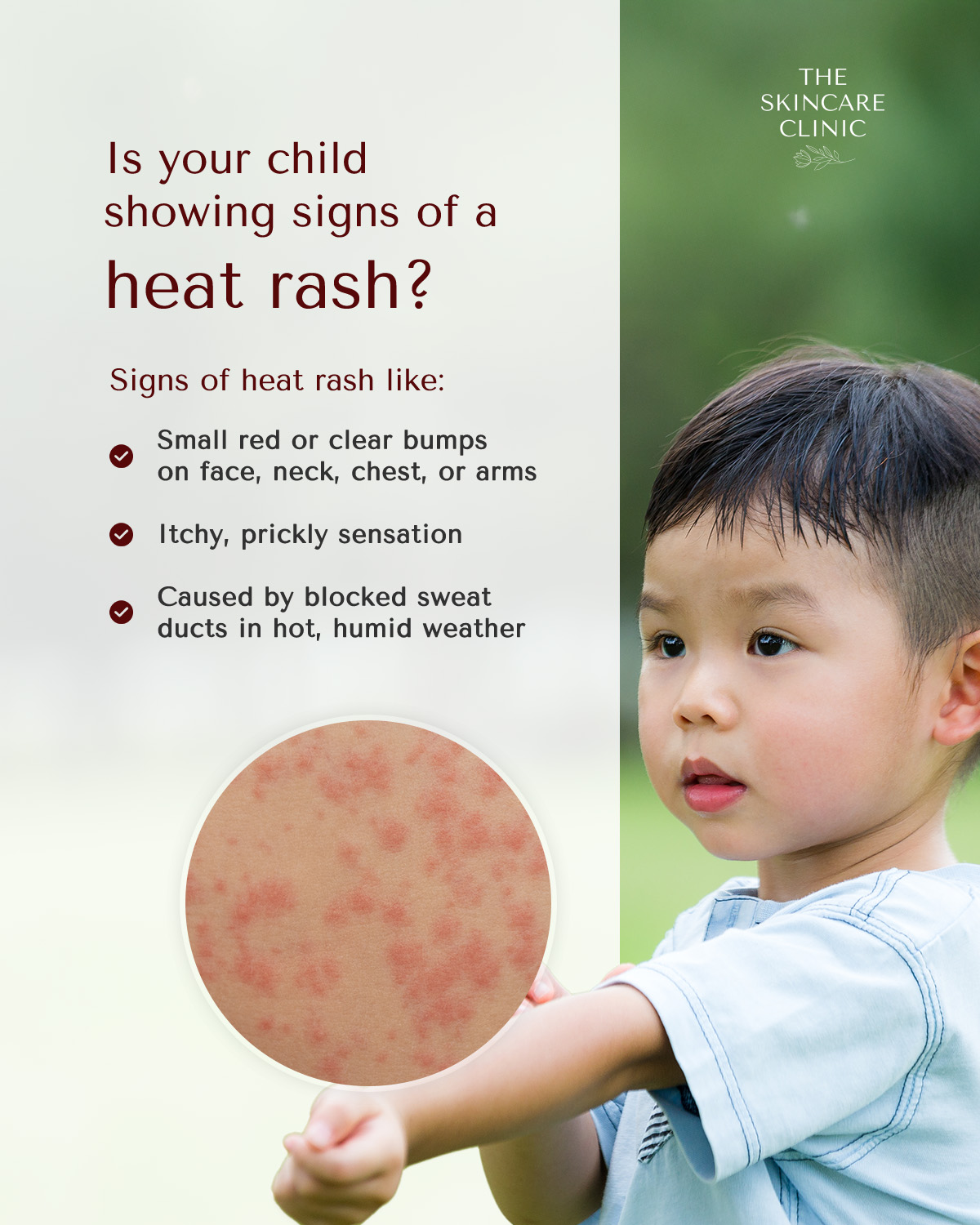 The Skincare - ☀️ Dealing with red, itchy bumps on your skin? It could ...