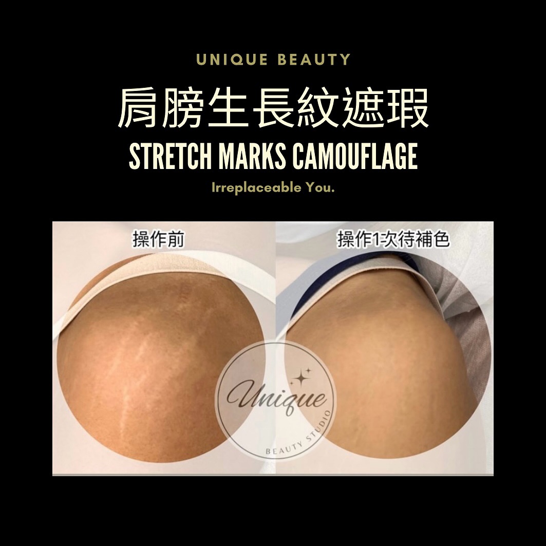 獨特美學 Unique Beauty Studio｜半永久皮膚遮瑕｜膚色重建｜花瓣粉嫩乳暈｜乳暈重建｜歐式毛流感仿真飄眉