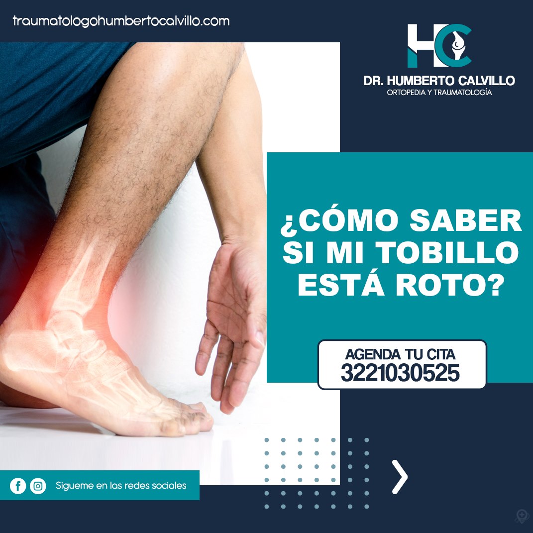 👉🏻 ¿CÓMO SABER SI MI TOBILLO ESTÁ ROTO? 🧿 Siempre es importante acuir a ...