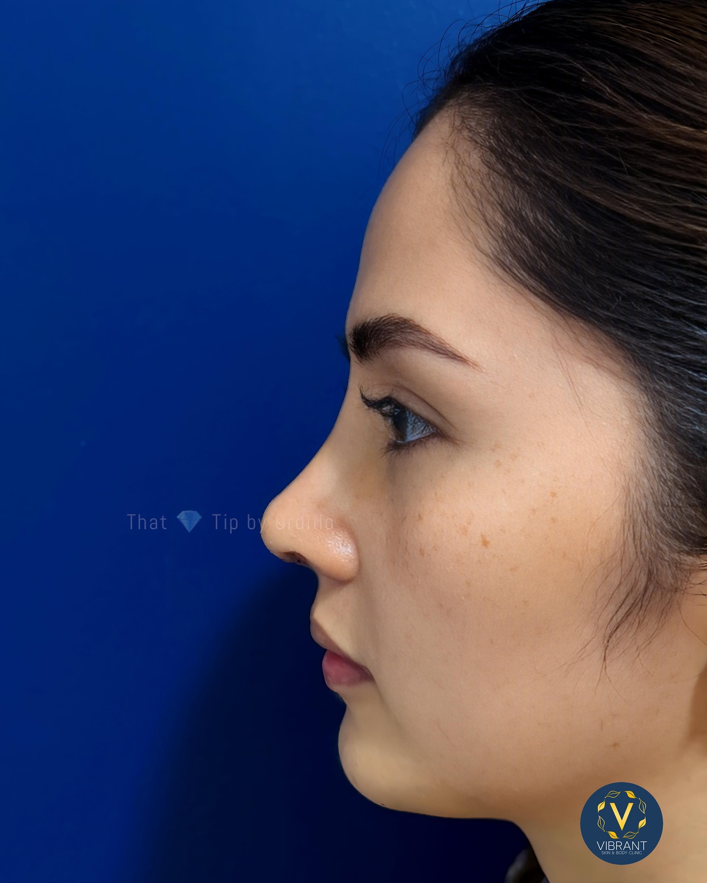 Vibrant Skin & Body Clinic by Dr. Ordillo | Antipolo