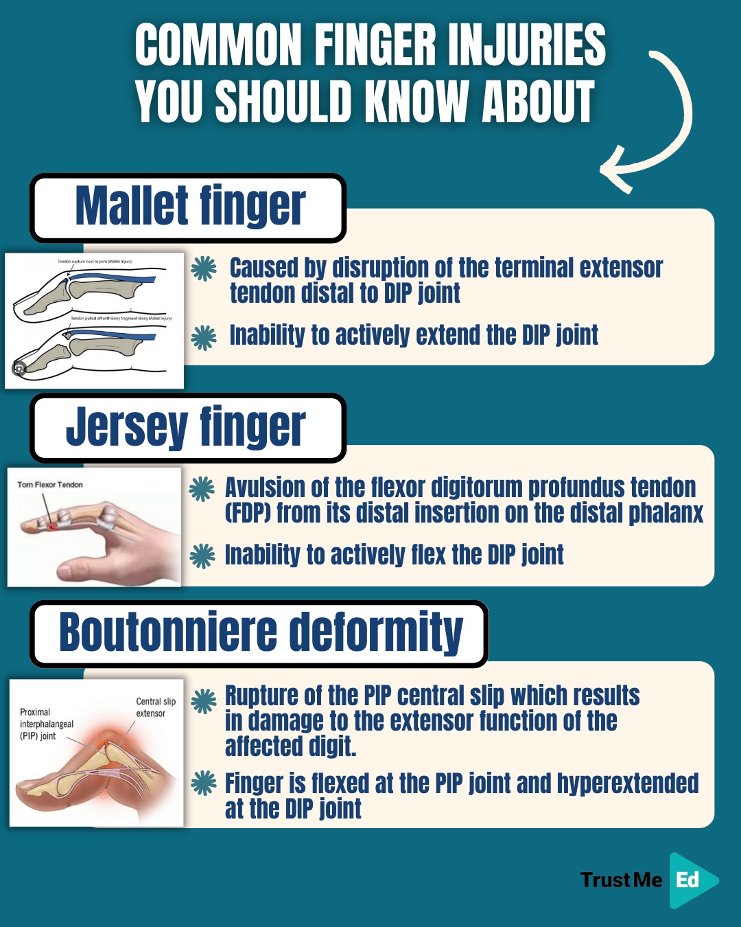 Trust - ⌨️🥊 The most common finger injuries occur because of how much ...