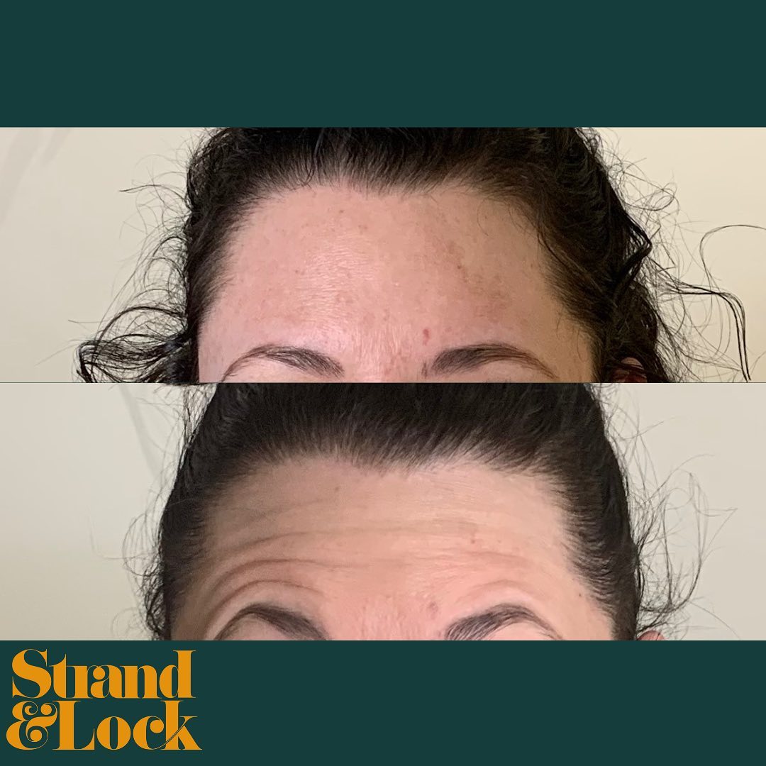 Strand & Lock - Are you tired of looking older than you...
