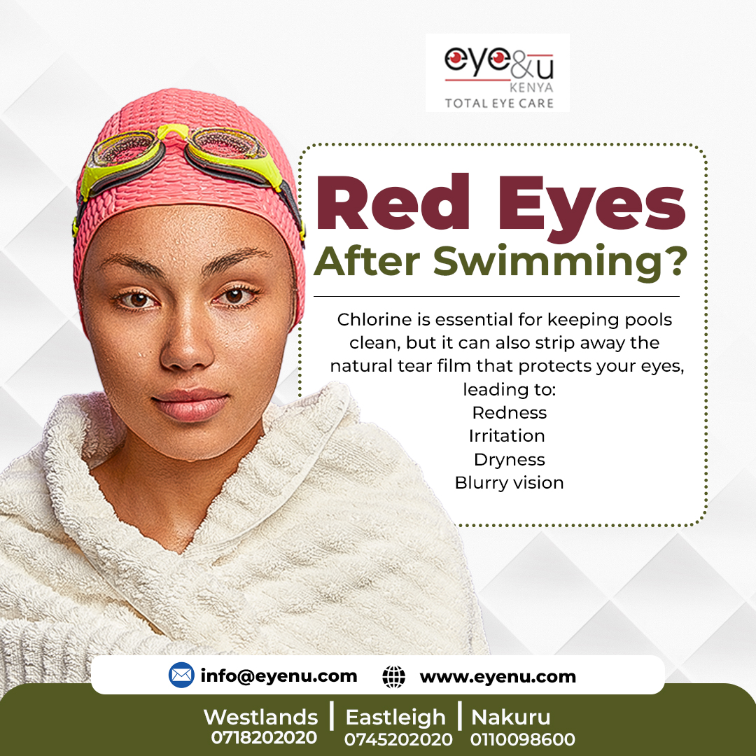 Eye - Eyes red after a swim? You’re not alone. That post-swim sting isn ...