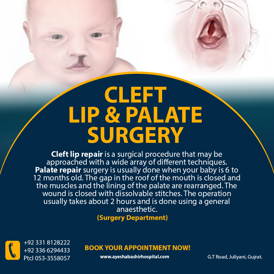 CLEFT LIP & PALATE SURGERY Cleft... - Ayesha Bashir Hospital
