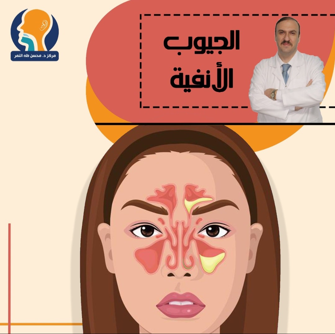 الجيوب الأنفية👃🏻هى من أكثر الأمراض المنتشرة والى بتضر الأنف بشكل كبير 😷 ...