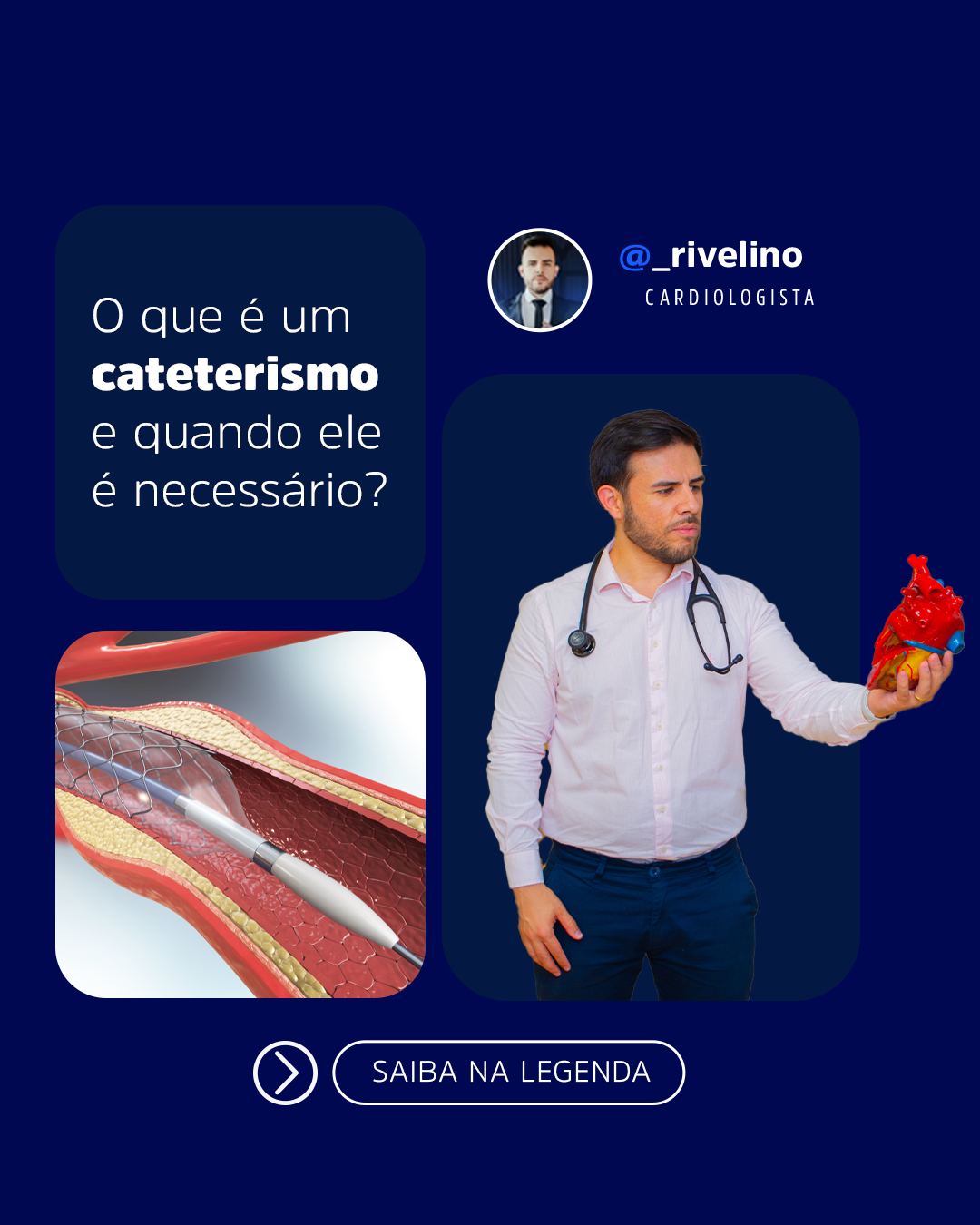 Rivelino - O cateterismo cardíaco é um exame para avaliar e tratar ...