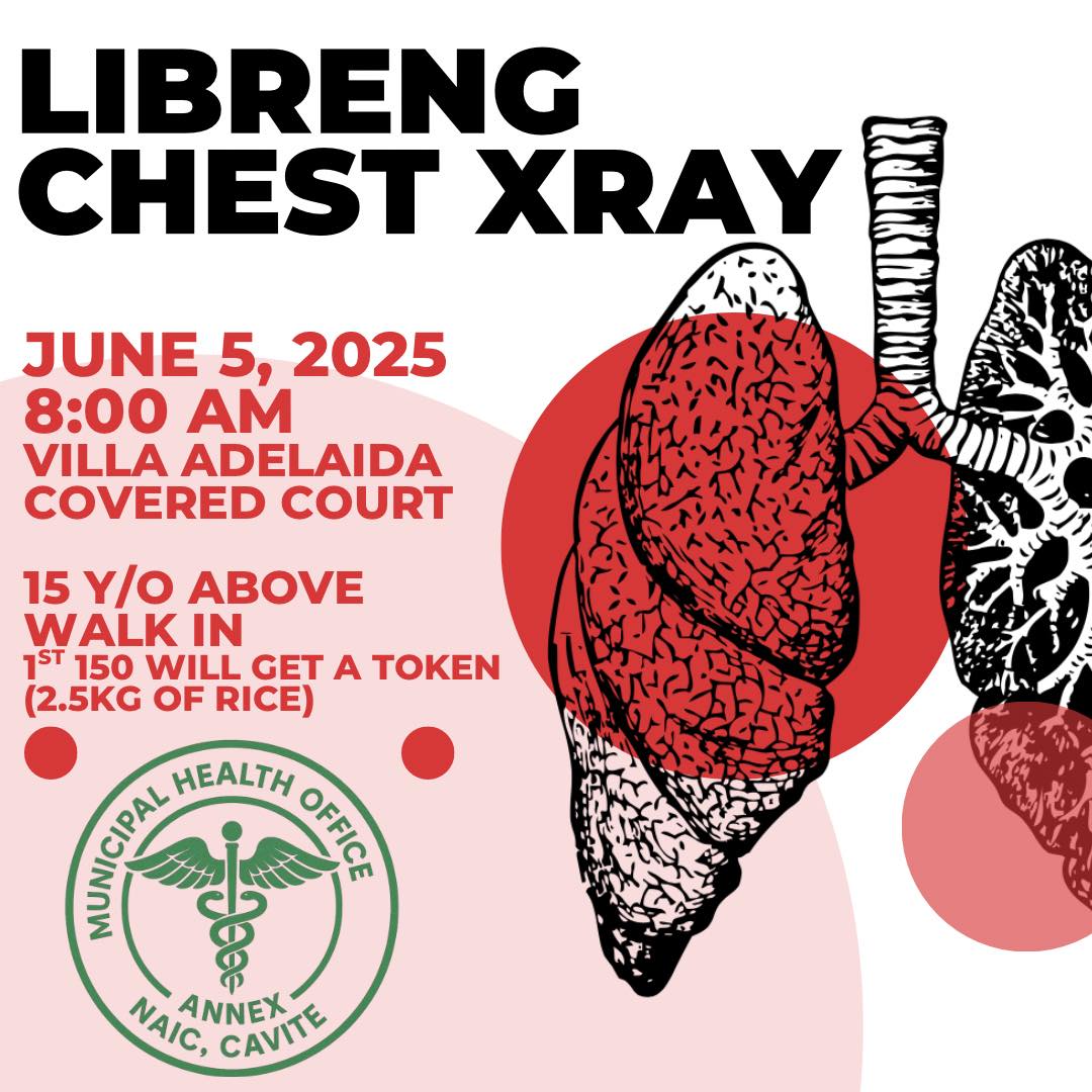 Naic - Libreng Chest X-ray | First come, first served para sa unang 150 ...