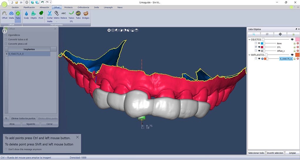 Endodontics.es - 🎯 ENDO GUIADA 🎯 Aprendiendo a usar...