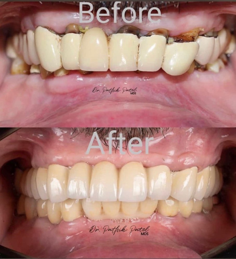 A2Z Dental Solutions (@a2zdentalsolutions) • Facebook
