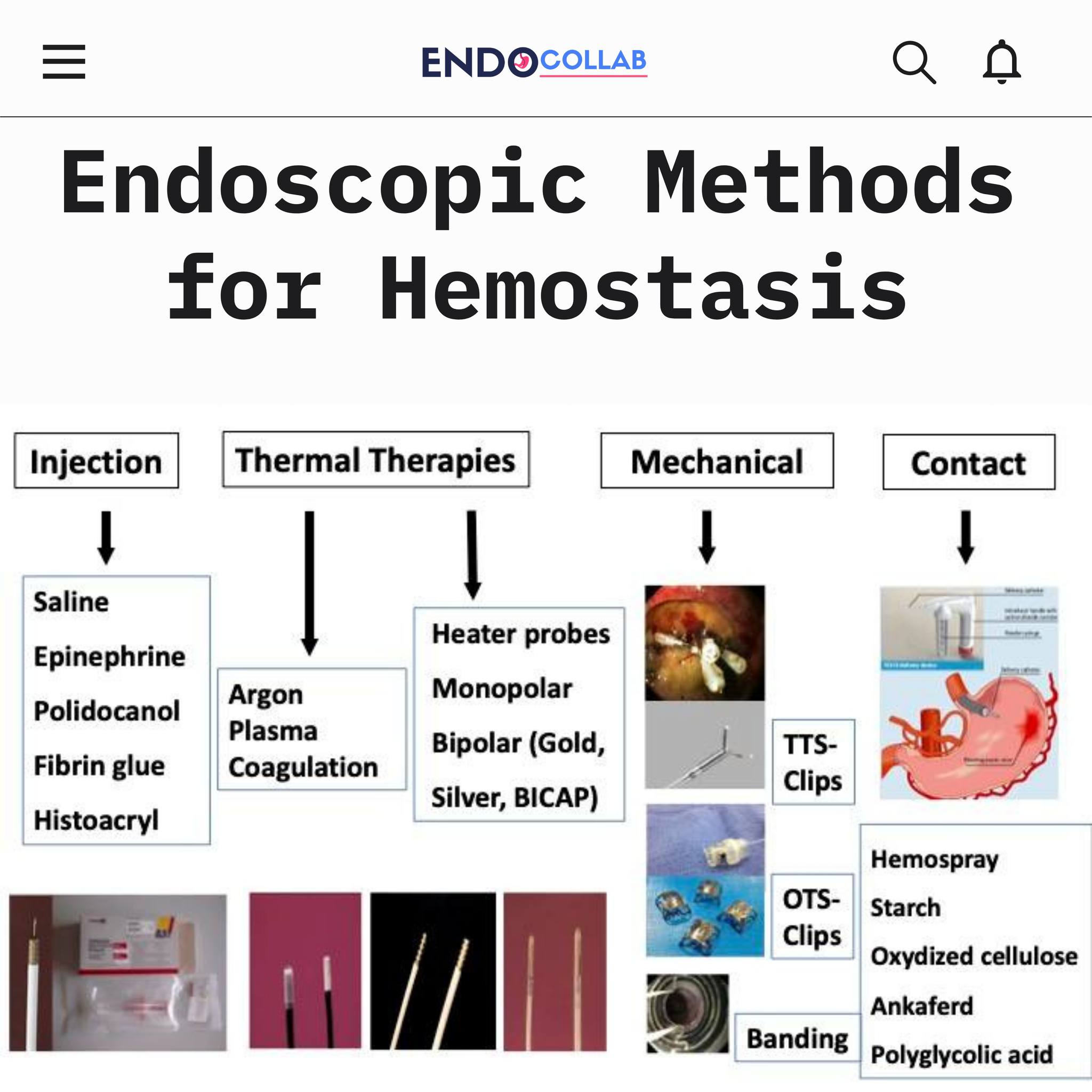 EndoCollab - 🩺 Endoscopic Hemostasis Techniques – Categorized by ...