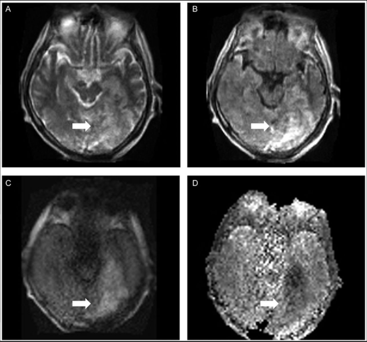 Canadian Journal of Neurological Sciences