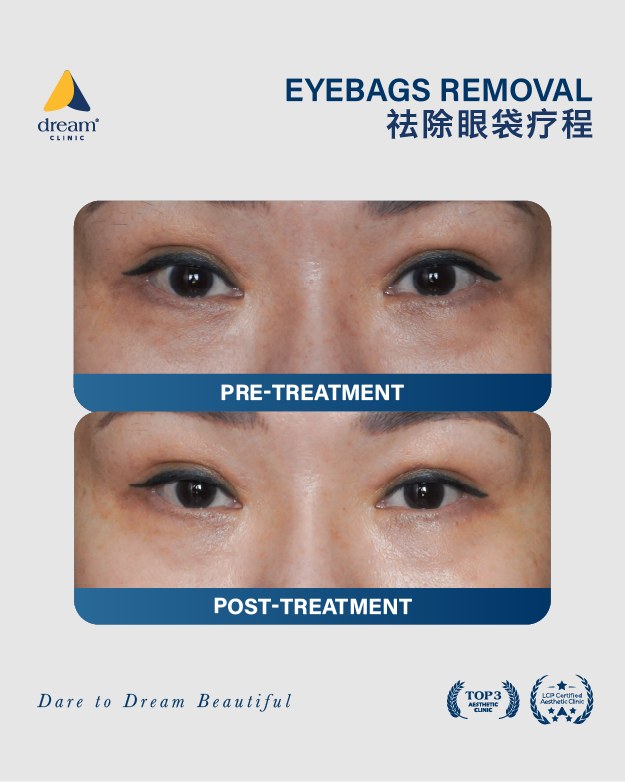 Dream - 'Cucumbers fix eye bags' - FALSE. Our collagen-stimulating ...