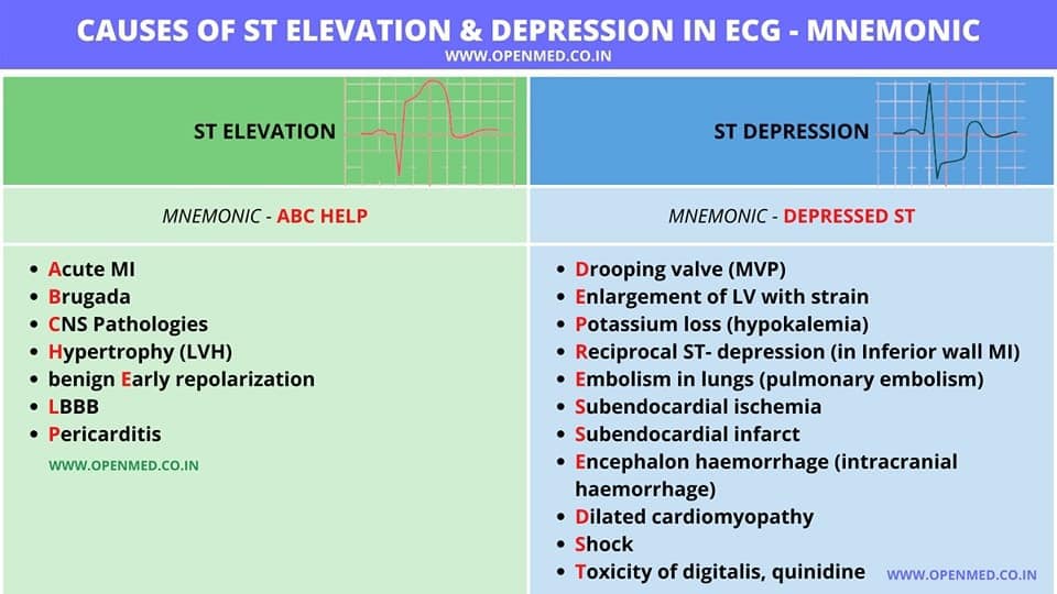 Vince - 🔴Causes of ST Elevation & Depression in ECG - MNEMONIC⤵️ 🔹 ...