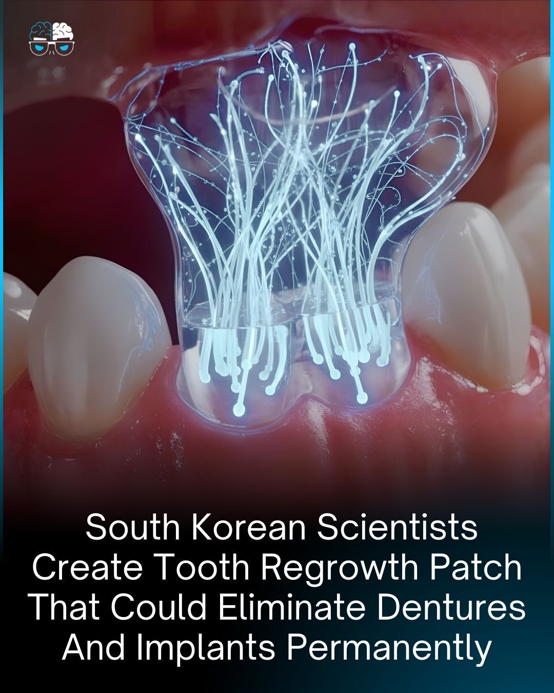 Factology - The age of missing teeth may be ending one patch at a time ...
