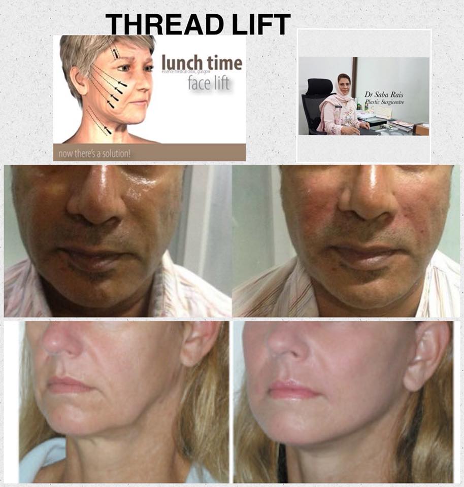 Dr. Saba Rais - #drsaba#dermatologist #derma #tightening...
