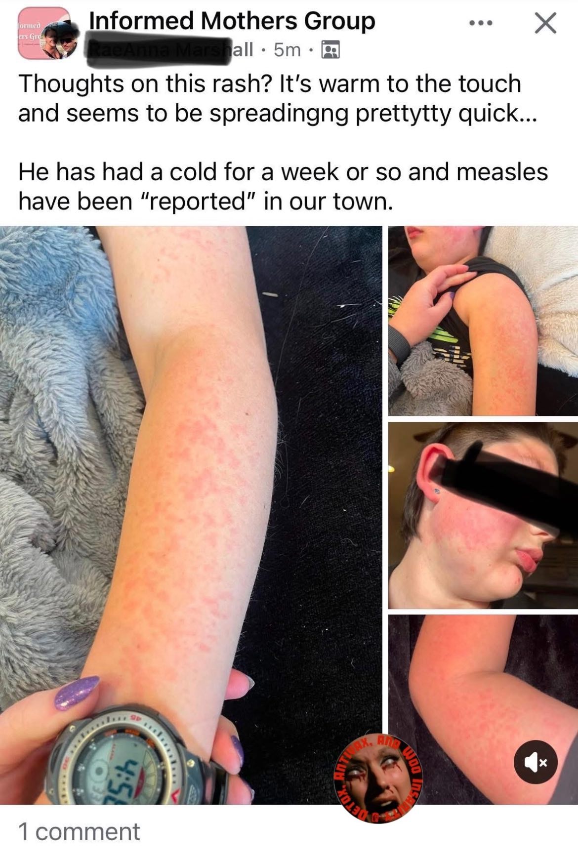 Detox, - Using quotation marks for the word reported when your child ...