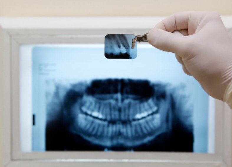 Smile Smart Dental Center | Bradenton FL