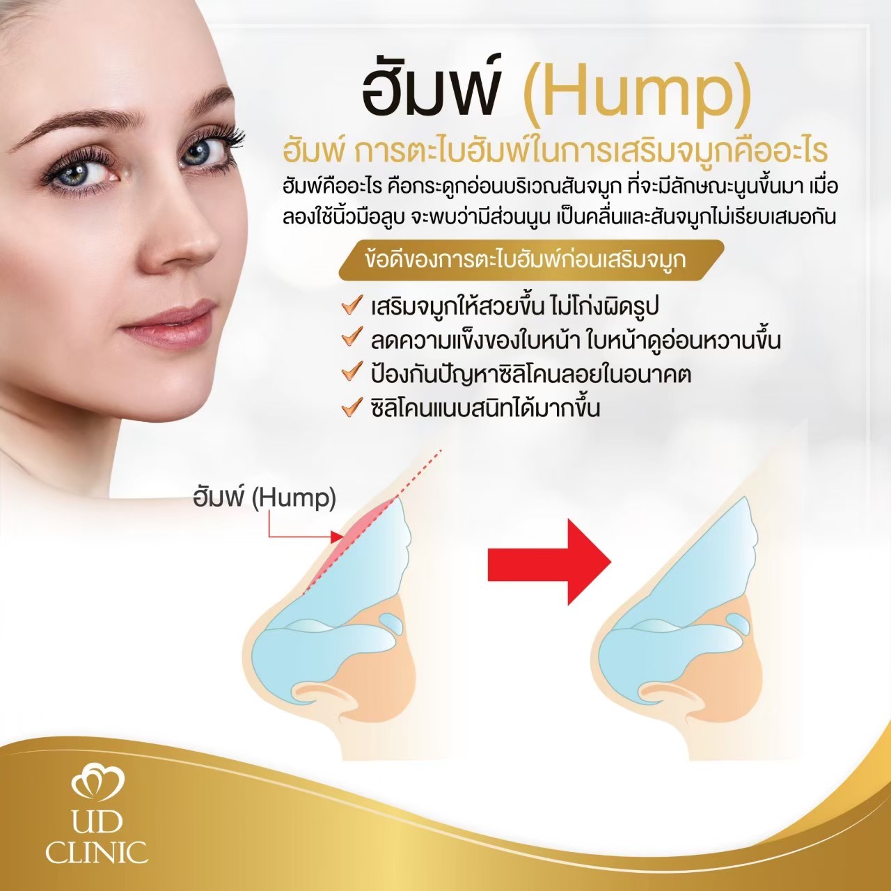 UD - มาทำความรู้จักกับคำว่า 