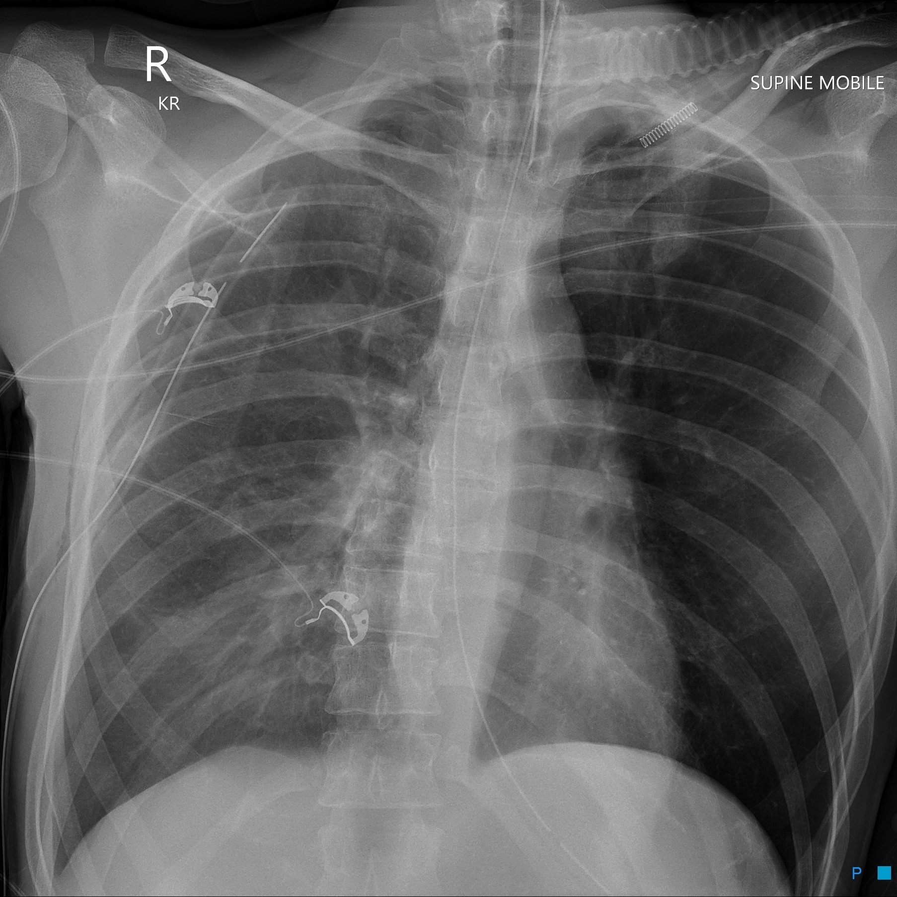 Radiopaedia.org - 🎯Clinical history: High speed road traffic accident ...