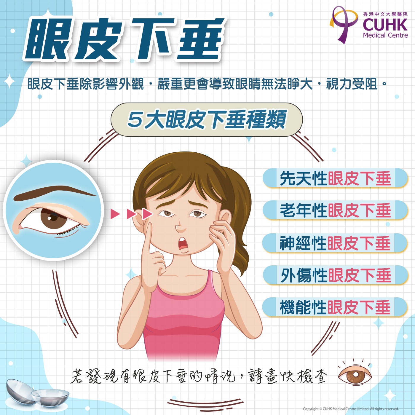 [健康錦囊] 眼皮下垂的成因 當上眼瞼（俗稱眼皮）的高度比黑色瞳仁... - CUHK Medical Centre