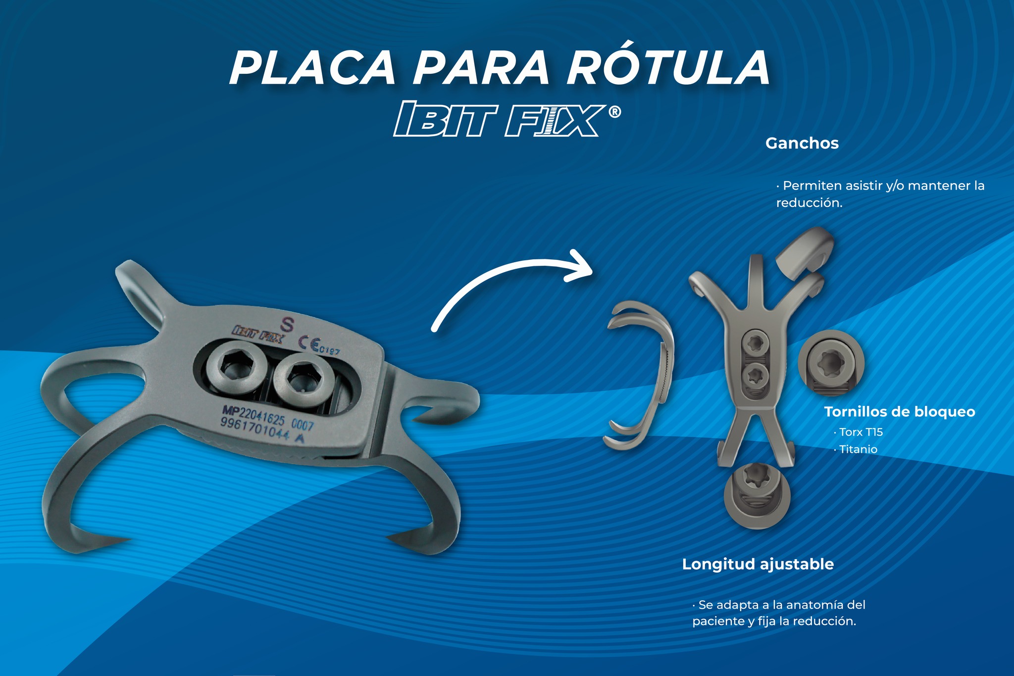 Proissa - Nuestra placa para rótula IBITFIX consta de un...