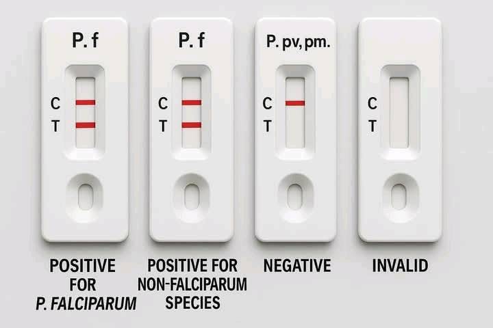 Malaria Rapid Diagnostic Test (RDT) practical 1. Objective The ...