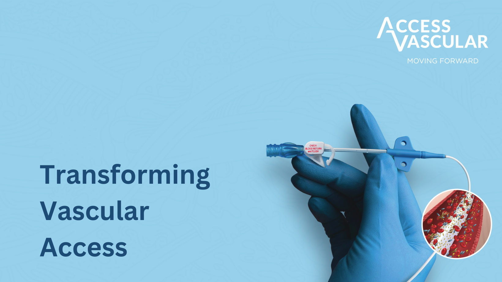 Access Vascular, Inc.