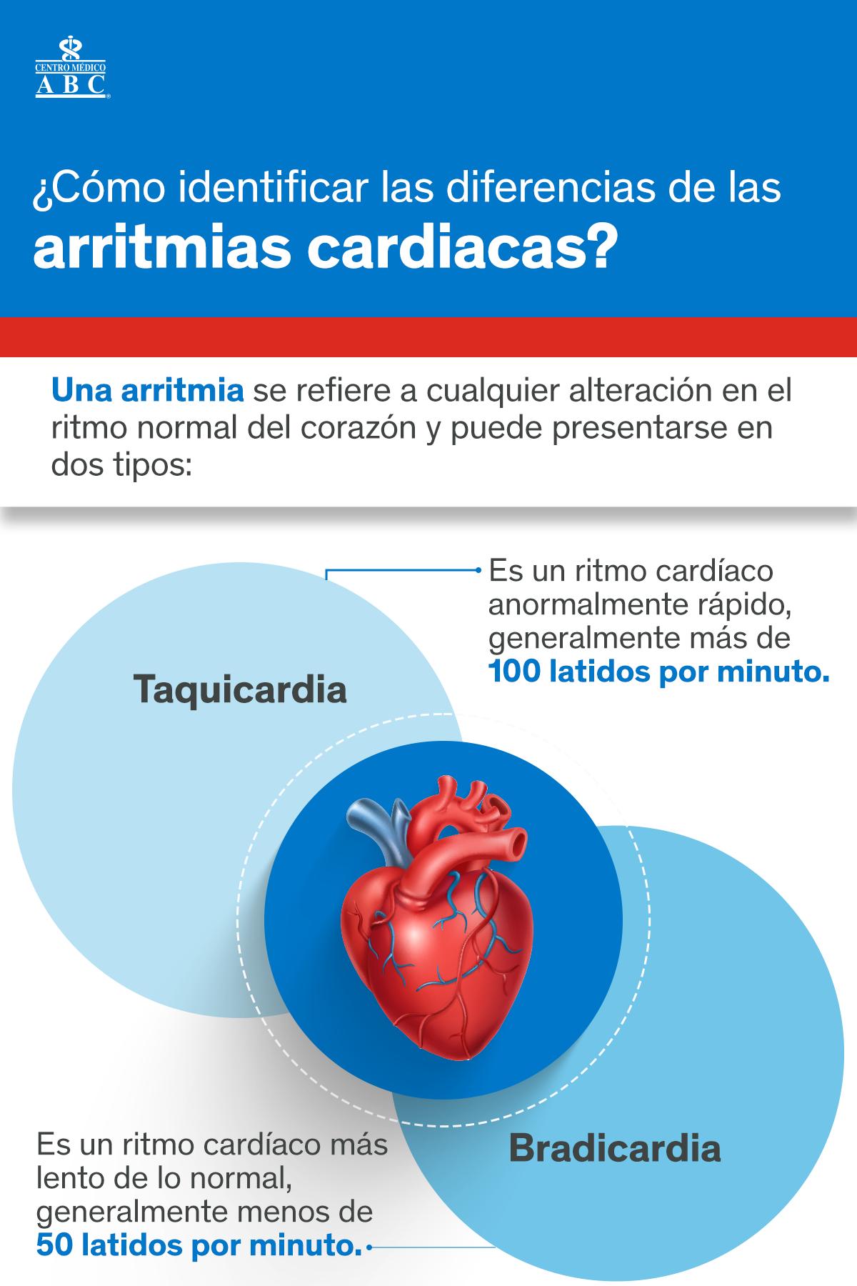 El ritmo normal del corazón va de los... - Centro Médico ABC