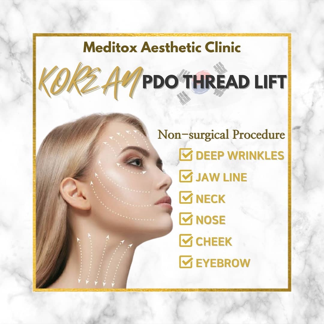 Meditox Aesthetic Clinic - PDO Thread Lifting (Made in S.Korea 🇰🇷) / 실 ...