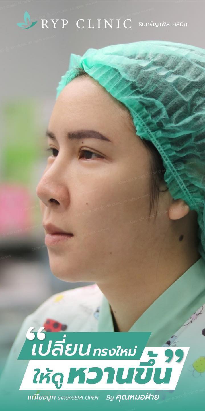 Review... - รินทร์ญาพัส คลินิก Rinyaphat Clinic - RYP | Facebook