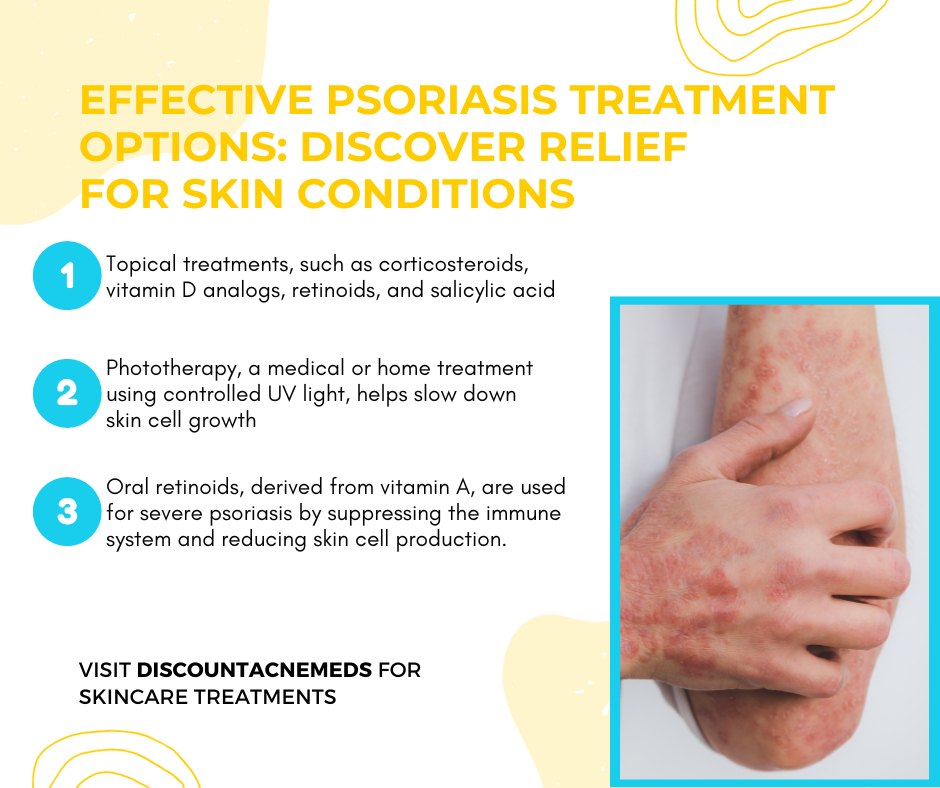 Peptide therapies for autoimmune diseases like psoriasis?