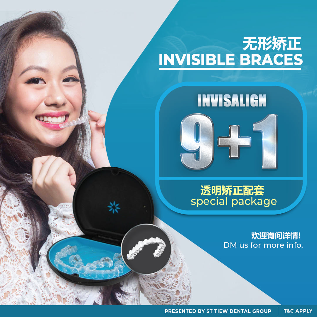 Straighten your teeth with... - ST Tiew Dental Group | Facebook