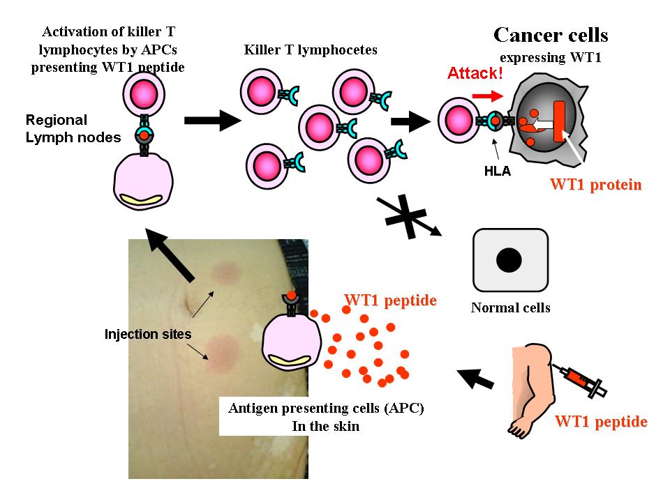 Kick Rocks Cancer