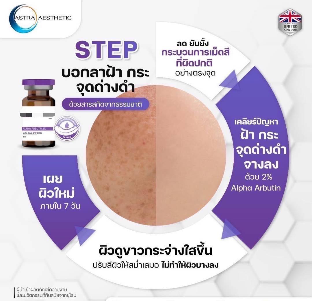 Nasiri - ใครเป็นฝ้า ทักมาค่ะ🥰 Neoclear เมโสรักษาฝ้า 1 เดียว ที่ไม่แสบ ...