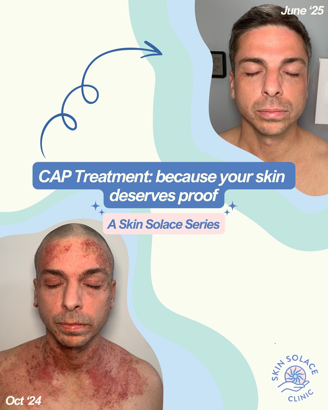 Skin Solace Clinic | Andover