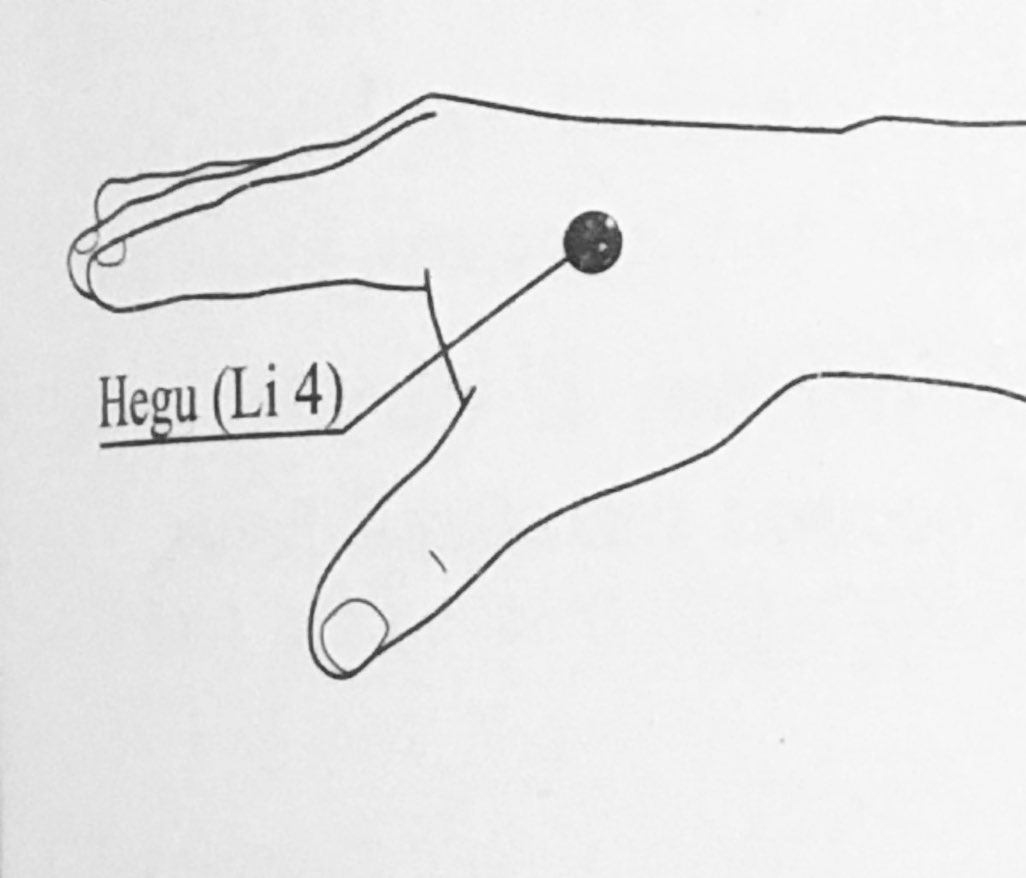 Here are some Acupuncture... - Chinese Healing Arts Center