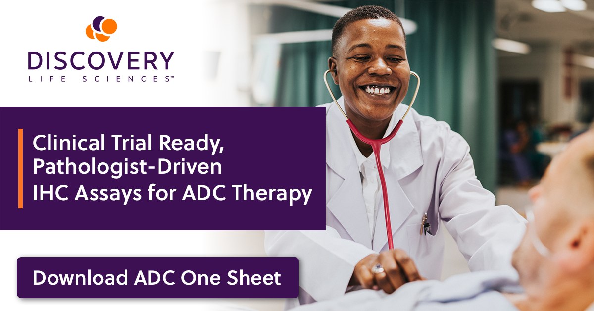 Antibody-drug conjugate therapy... - Discovery Life Sciences