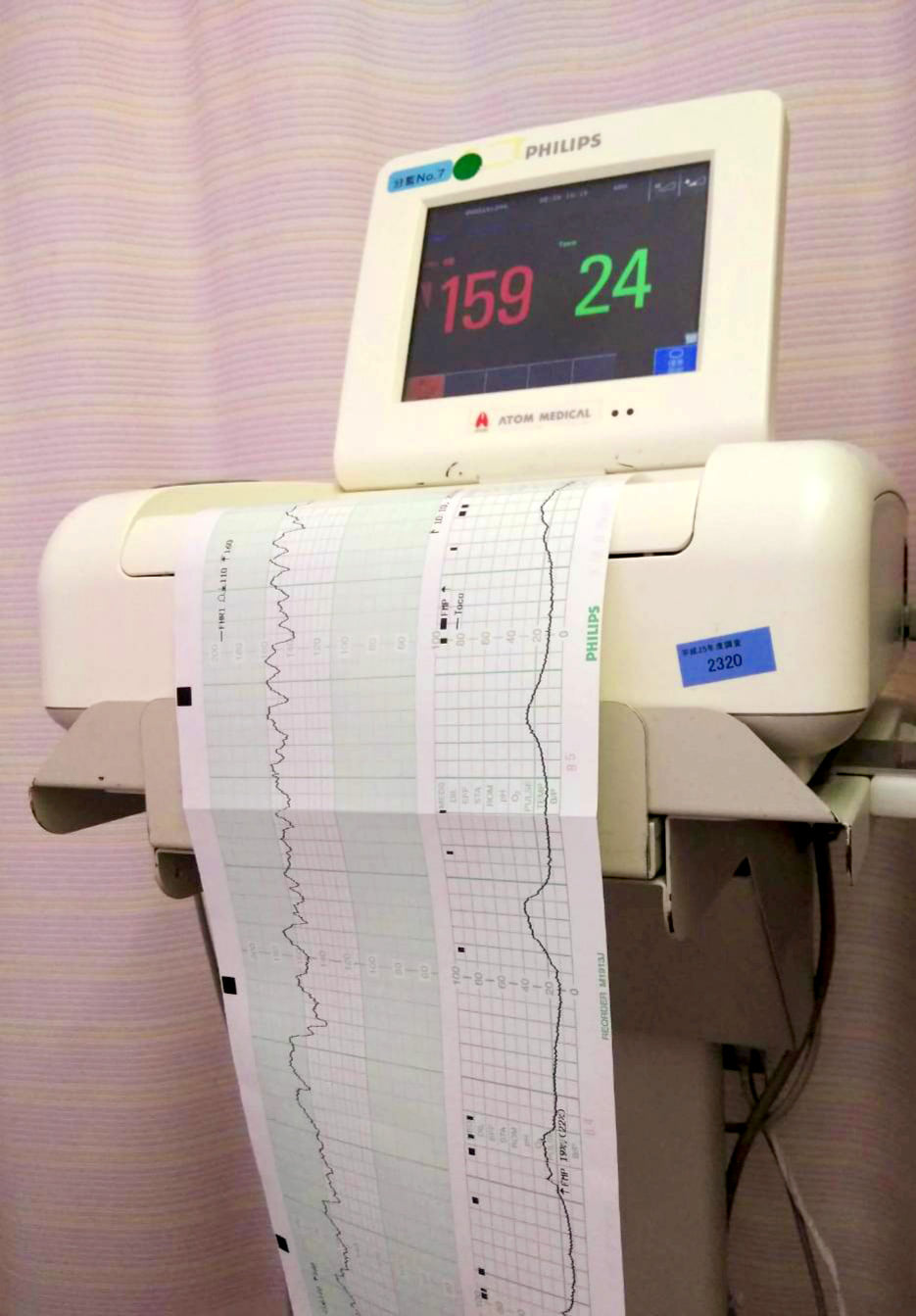 nst モニター 見方