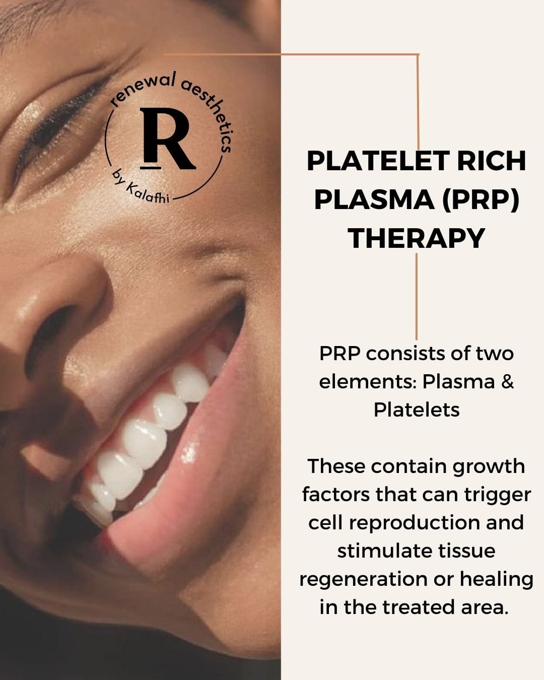 NEW PRP THERAPY Platelet Rich Plasma... - Renewal Aesthetics | Facebook