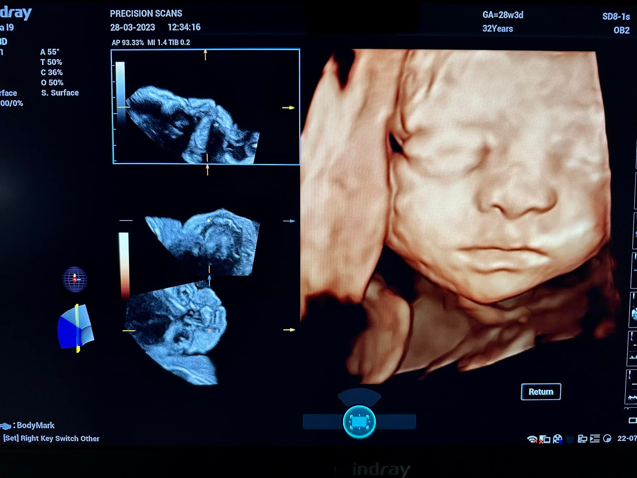Precision Scans | Chikmagalur