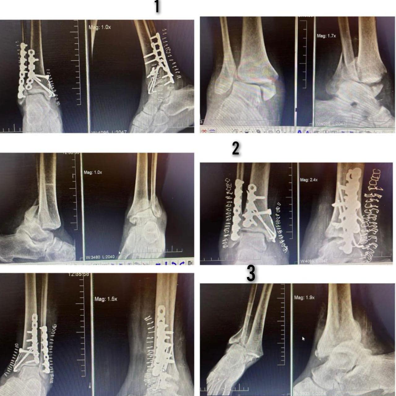 Raninga Orthopaedic Hospital | Khambhalia