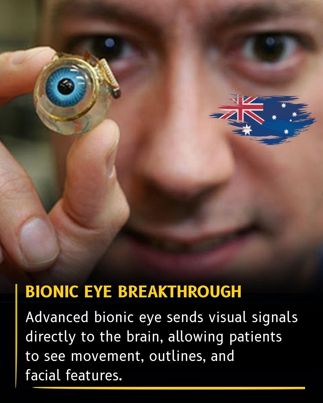 Science - Australian researchers have unveiled the world’s first fully ...
