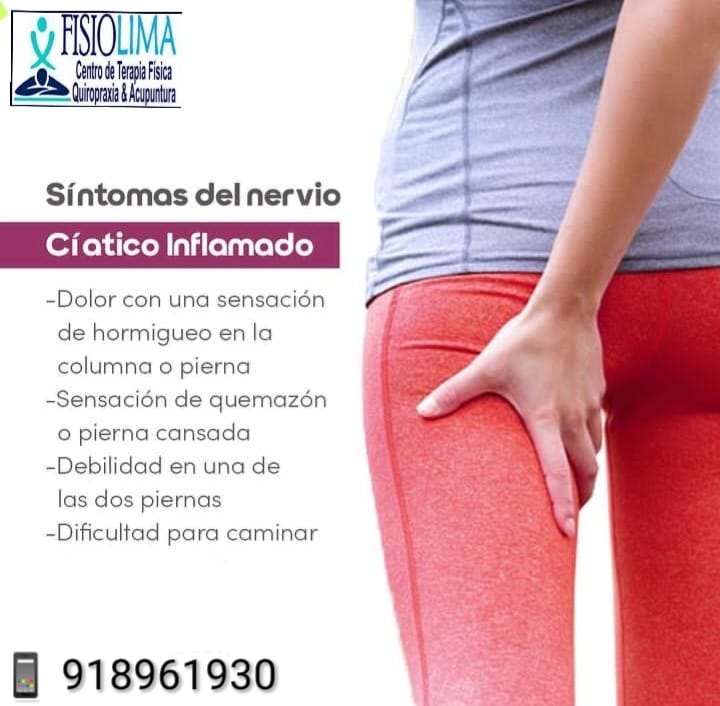 Fisiolimaperu - ⚠️A. L. E. R. T. A⚠️ 🚫 SE TE ADORMECE UNA O AMBAS ...