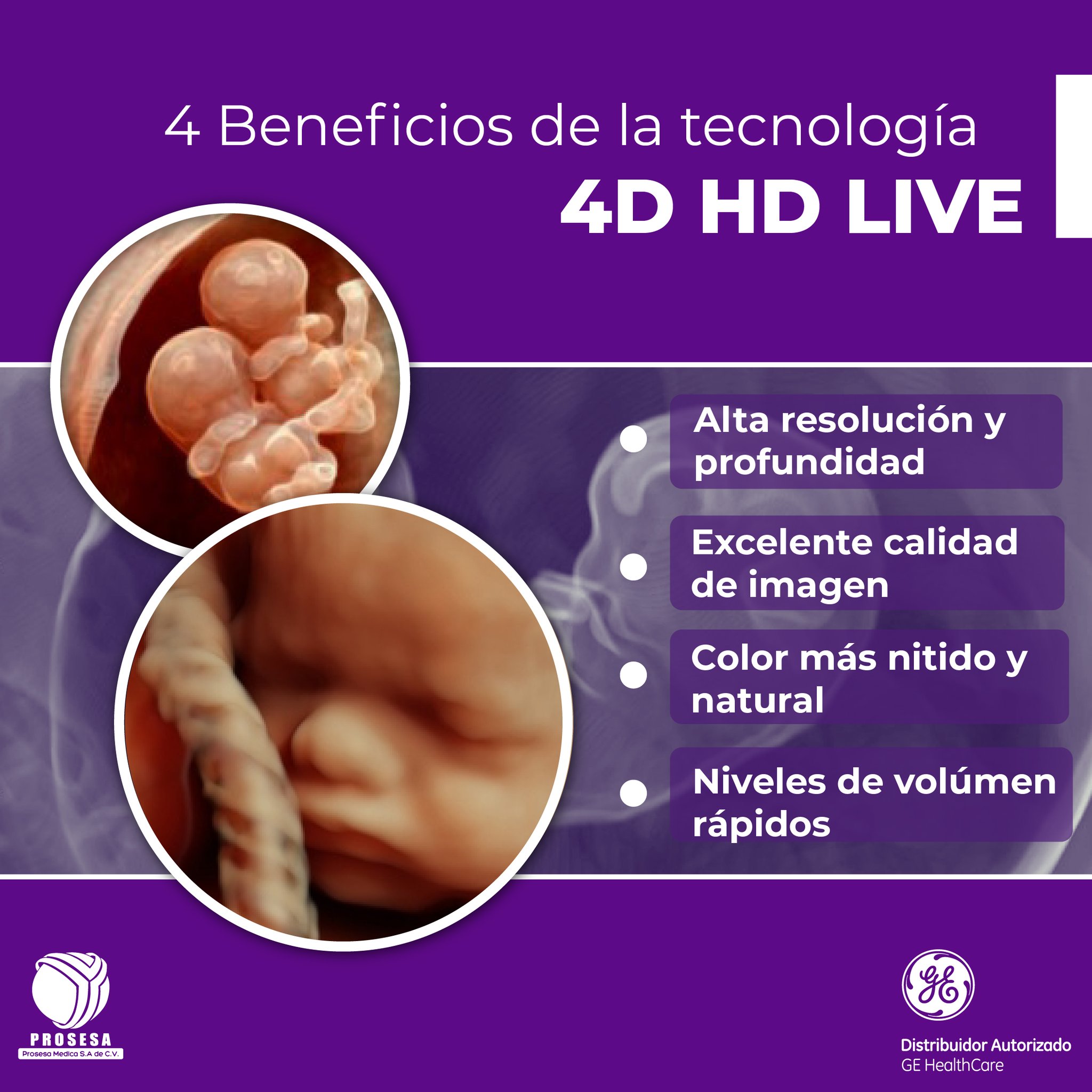 Prosesa - El conjunto de tecnologías HDlive™ es la última generación en ...