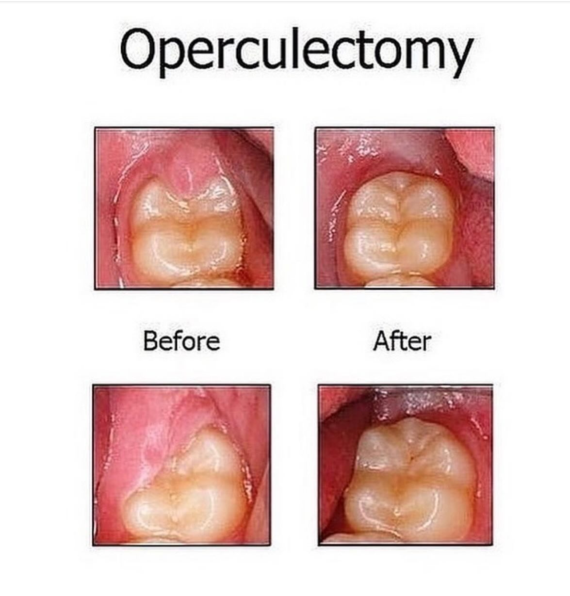 Dr. - Click to see the transformation! From discomfort to confident ...