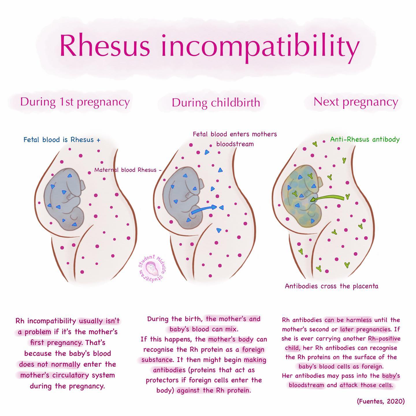 💕 Rhesus incompatibility and... - Student Midwife Studygram